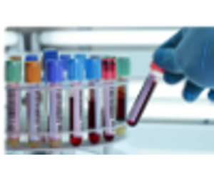 The blood sample